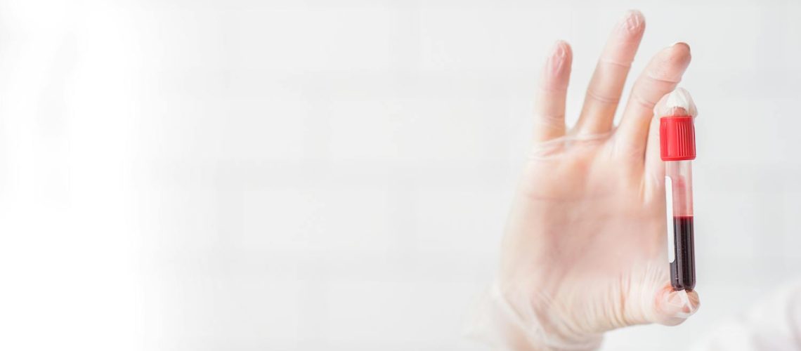 Adrénochrome : l'histoire d'un mythe glaçant